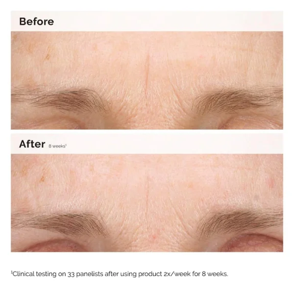 The Ordinary Retinal 0.2% Emulsion - Imagen 3