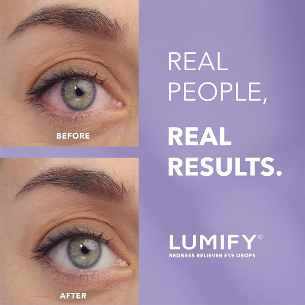 Lumify Gotas Oftálmicas para Reducir el Enrojecimiento - Imagen 2