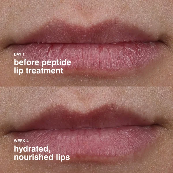 Rhode Peptide Lip Treatment | Tratamiento de Labios con Péptidos - Imagen 4